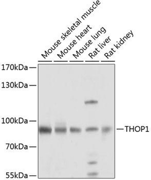 Anti-THOP1 Antibody (CAB8756)
