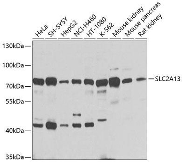 Anti-SLC2A13 Antibody (CAB9993)