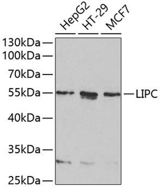 Anti-LIPC Antibody (CAB1430)