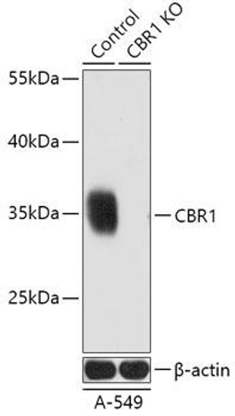 Anti-CBR1 Antibody (CAB18074)[KO Validated]