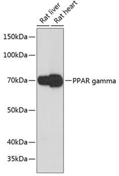 Anti-PPAR gamma Antibody (CAB19676)