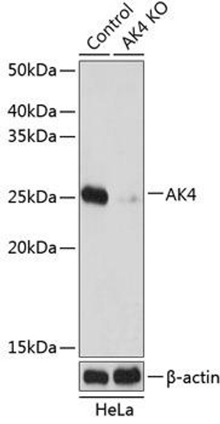Anti-AK4 Antibody (CAB19855)[KO Validated]