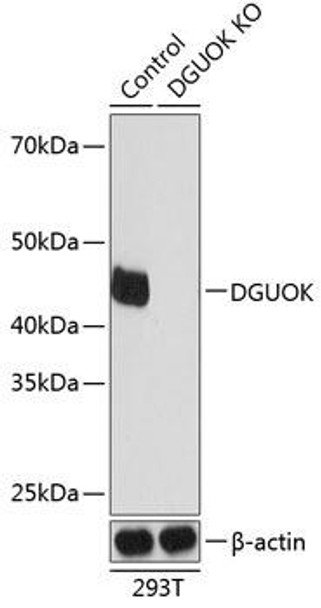 Anti-DGUOK Antibody (CAB19926)[KO Validated]