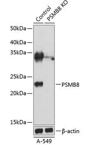 Anti-PSMB8 Antibody (CAB19933)[KO Validated]