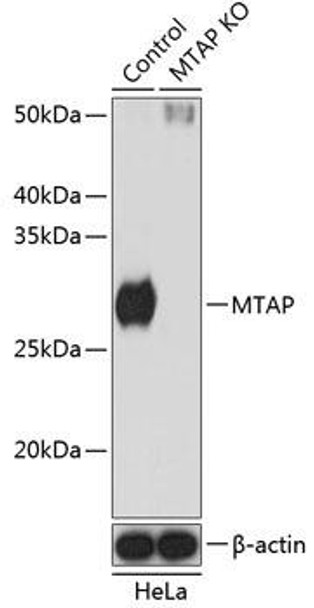 Anti-MTAP Antibody (CAB19981)[KO Validated]