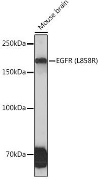 Anti-EGFR (L858R) Antibody (CAB5031)