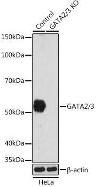 Anti-GATA2/3 [KO Validated] Antibody (CAB5083)