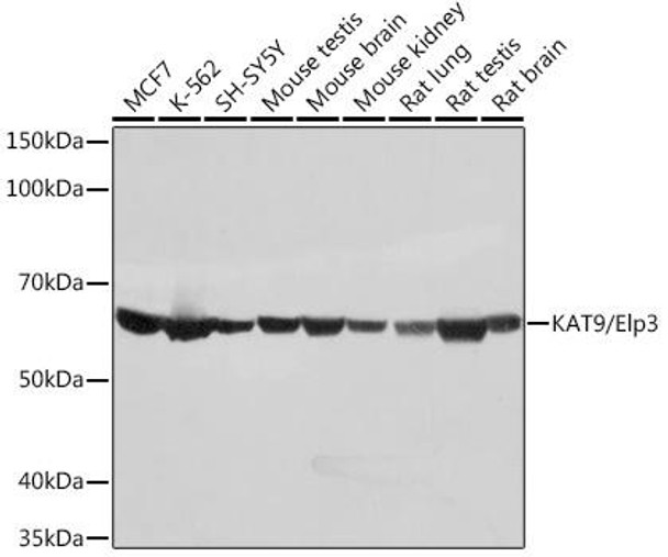 Anti-KAT9/Elp3 Antibody (CAB0020)