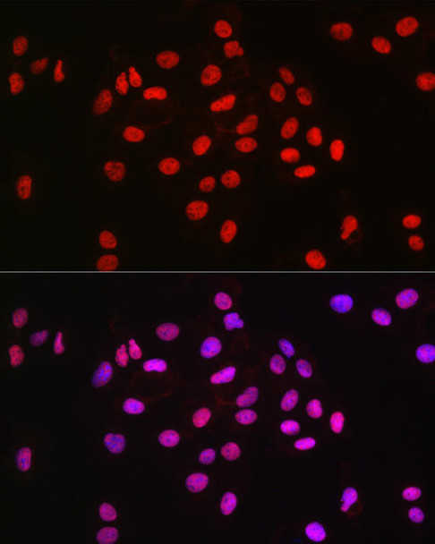 MCM2 Monoclonal Antibody (CAB20699)