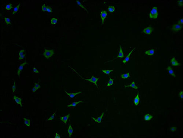 SEZ6 Antibody (PACO64941)