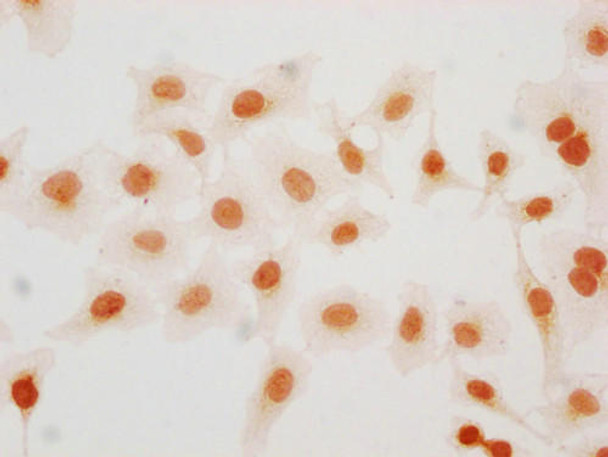 2-hydroxyisobutyryl-HIST1H2BC (K57) Antibody (PACO65046)