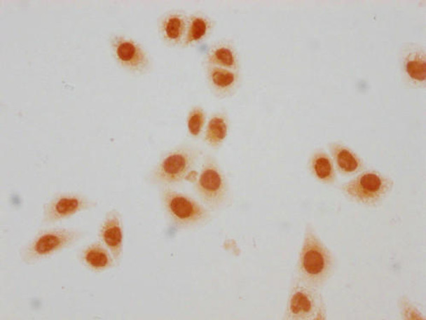 Crotonyl-HIST1H2BC (K23) Antibody (PACO65141)