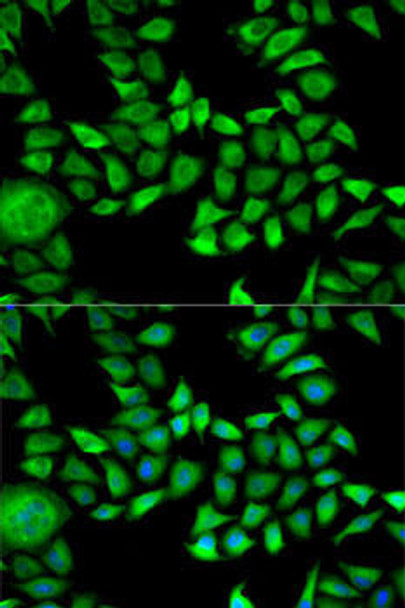 Anti-ANXA5 Antibody (CAB13945)