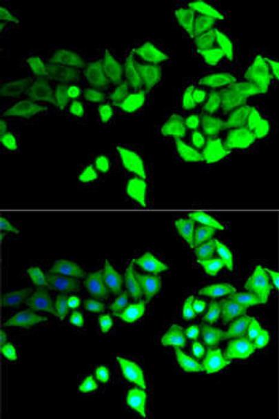 Anti-BEST1 Antibody (CAB14070)