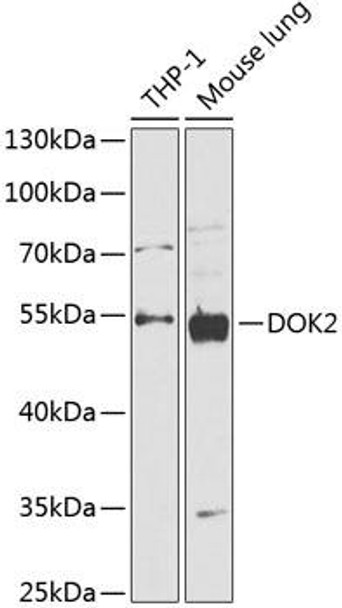 Anti-DOK2 Antibody (CAB14084)