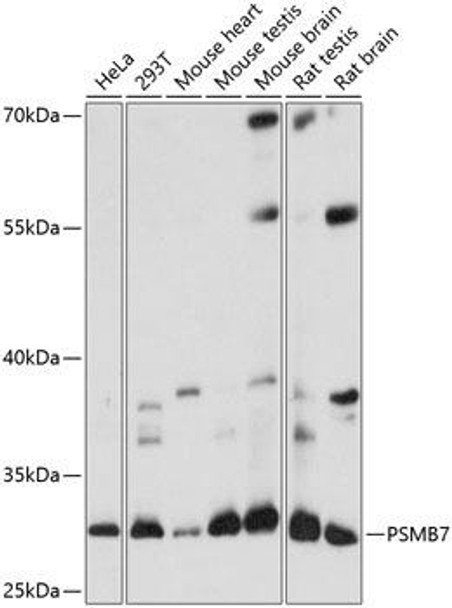 Anti-PSMB7 Antibody (CAB14771)