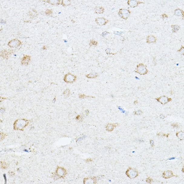 Anti-IL-1RAP Antibody (CAB5349)