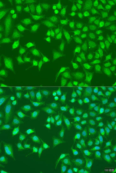 Anti-TRIM22 Antibody (CAB5508)