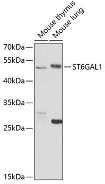 Anti-ST6GAL1 Antibody (CAB5754)