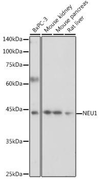 Anti-NEU1 Antibody (CAB6299)