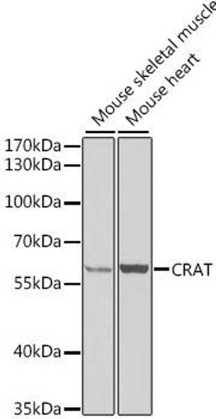 Anti-CRAT Antibody (CAB6365)