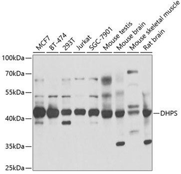 Anti-DHPS Antibody (CAB6367)