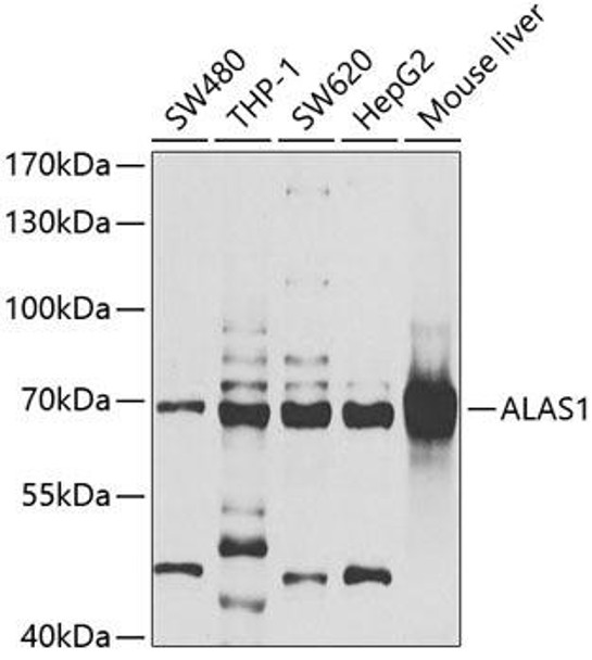 Anti-ALAS1 Antibody (CAB6521)