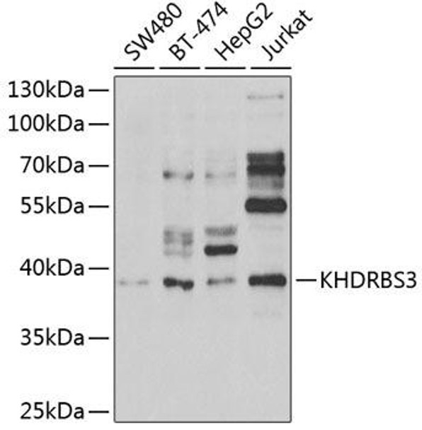 Anti-KHDRBS3 Antibody (CAB6637)