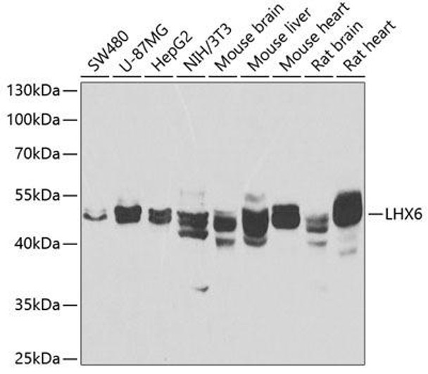 Anti-LHX6 Antibody (CAB7364)