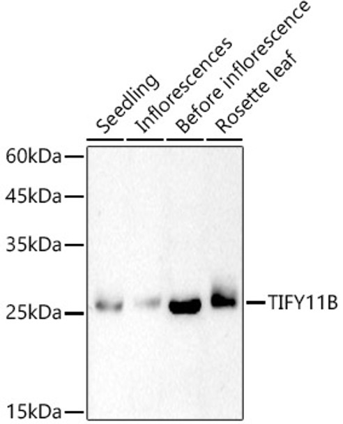TIFY11B Polyclonal Antibody (CAB21305)