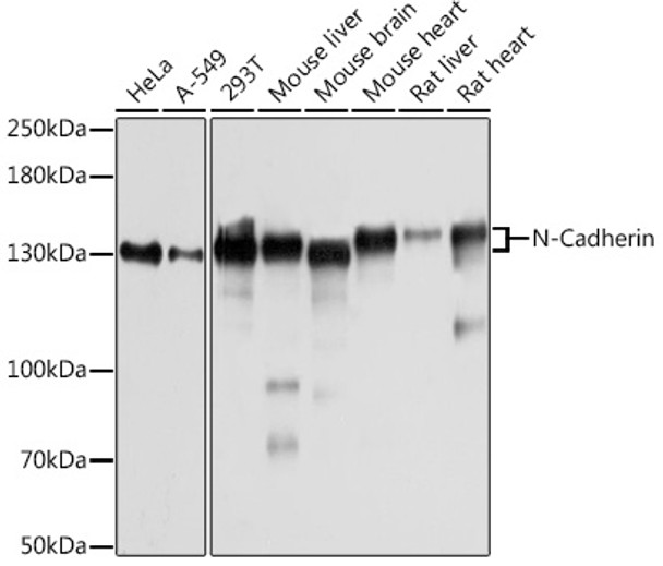 N-Cadherin Polyclonal Antibody (CAB21308)