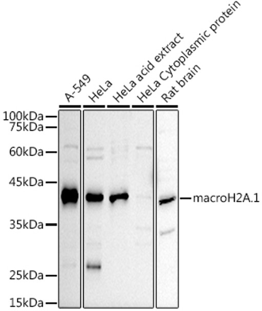 macroH2A.1 Polyclonal Antibody (CAB21836)