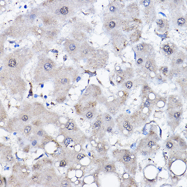 Anti-HSPA6 Antibody (CAB7688)