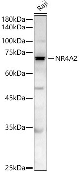 NR4A2 Polyclonal Antibody (CAB22011)