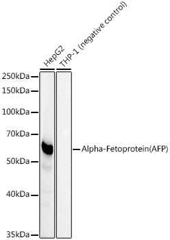 Alpha-Fetoprotein (AFP) Monoclonal Antibody (CAB22053)