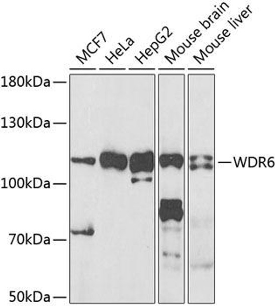 Anti-WDR6 Antibody (CAB7780)