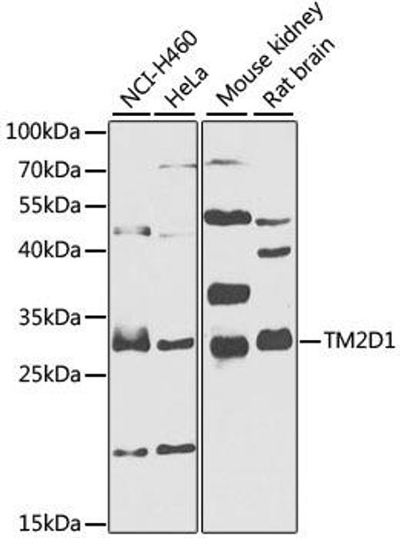 Anti-TM2D1 Antibody (CAB7840)