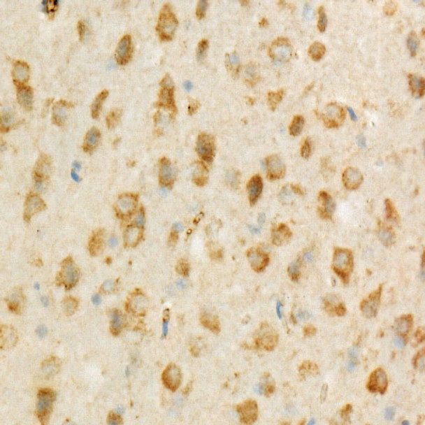 TSG101/VPS23 Monoclonal Antibody (CAB22762)