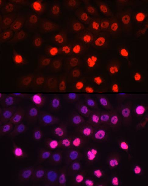 Engrailed 1 Polyclonal Antibody (CAB23060)