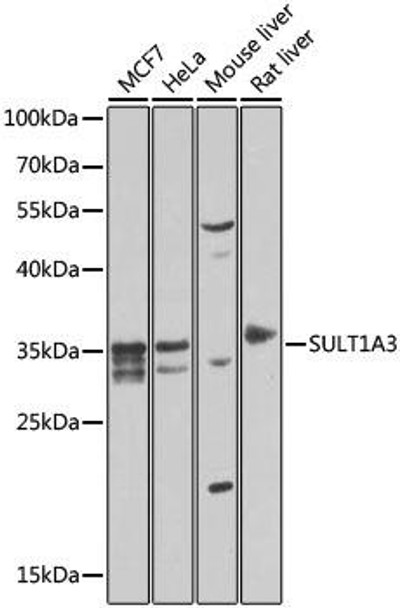 Anti-SULT1A3 Antibody (CAB7932)