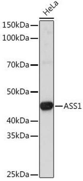 Anti-ASS1 Antibody (CAB16767)[KO Validated]