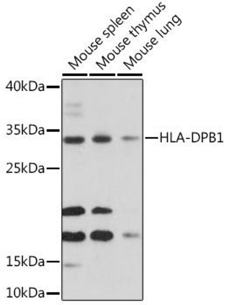 Anti-HLA-DPB1 Antibody (CAB16874)