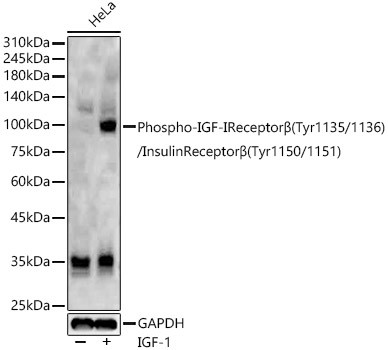 Phospho-IGF-IReceptorβ(Tyr1135/1136)/InsulinReceptorβ(Tyr1150/1151) Polyclonal Antibody (CABP1352)