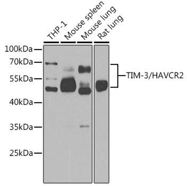 Anti-TIM-3/HAVCR2 Antibody (CAB17231)