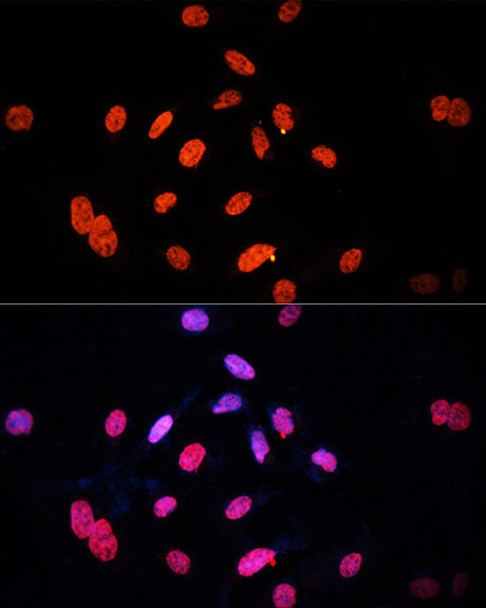 Anti-E2F1 Antibody (CAB17478)