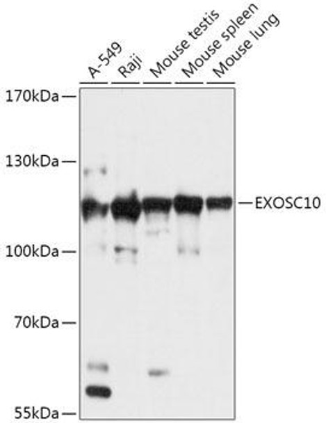 Anti-EXOSC10 Antibody (CAB17519)