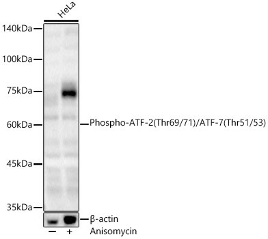 Phospho-ATF-2 (Thr69/71)/ATF-7 (Thr51/53) Polyclonal Antibody (CABP1429)