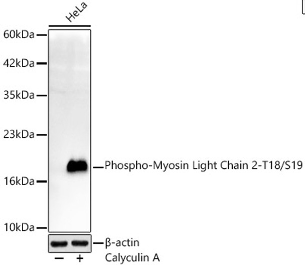 Phospho-Myosin Light Chain 2-T18/S19 Monoclonal Antibody (CABP1503)
