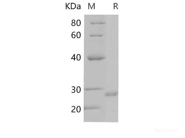 Human PIK3CA Recombinant Protein (His Tag) (RPES6182)