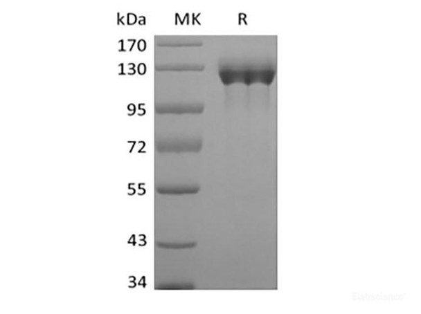 Recombinant Human G-CSFR/CD114/CSF3R (C-Fc) (RPES6197)